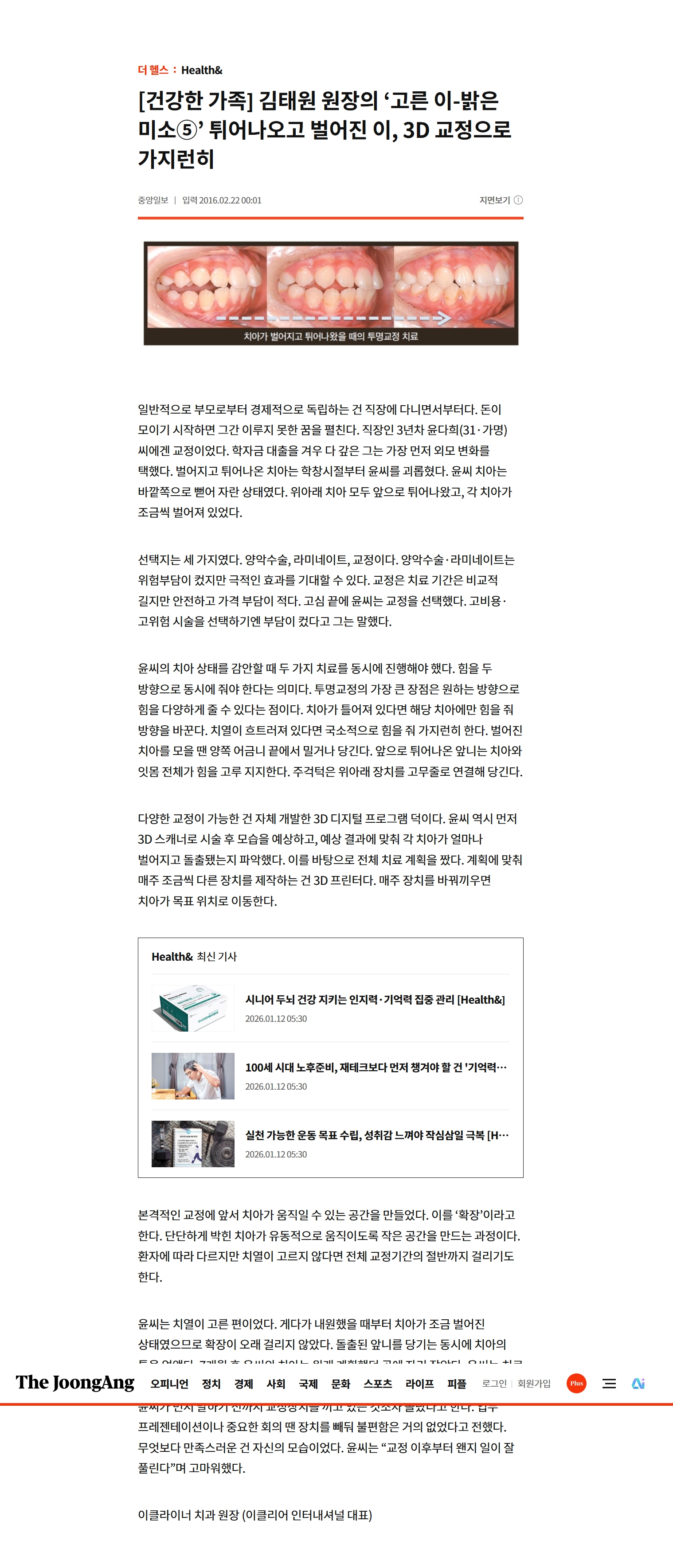 언론보도