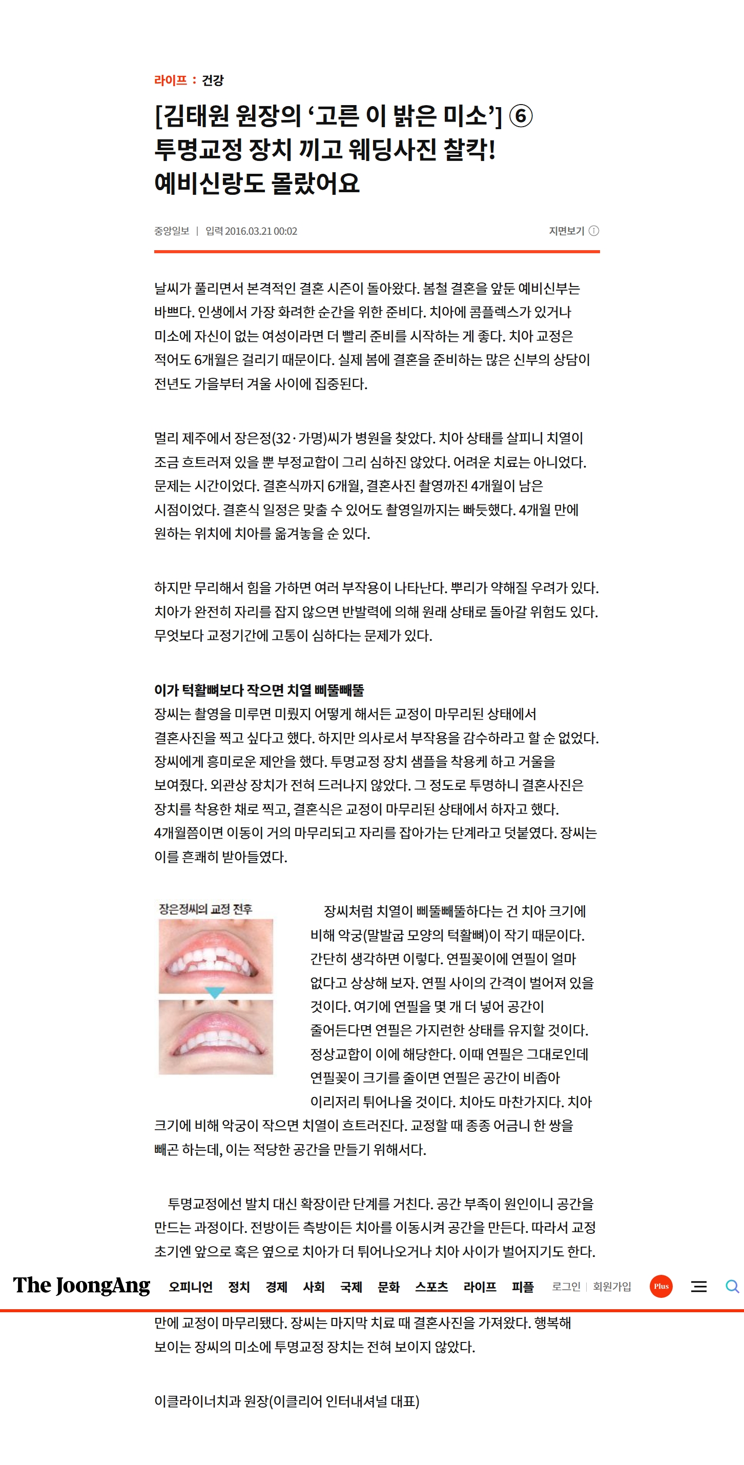 언론보도